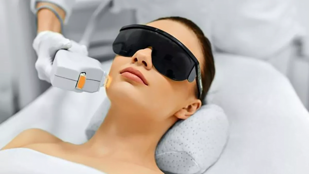 depilacion laser facial