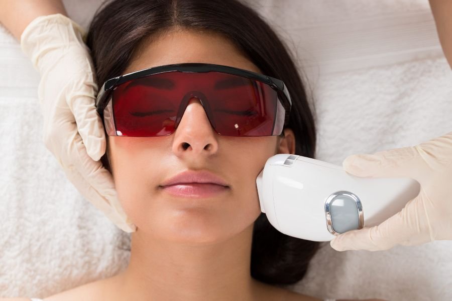 rejuvenecimiento facial laser