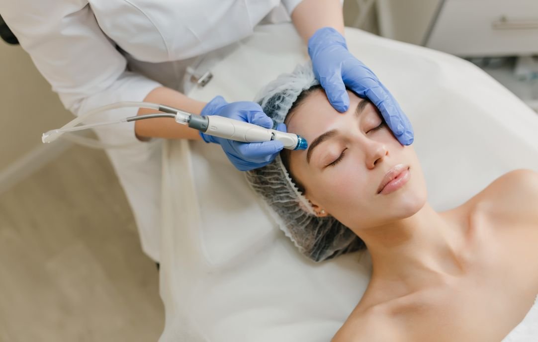 Procedimientos de Medicina Estética para Mejorar la Apariencia de las Cicatrices