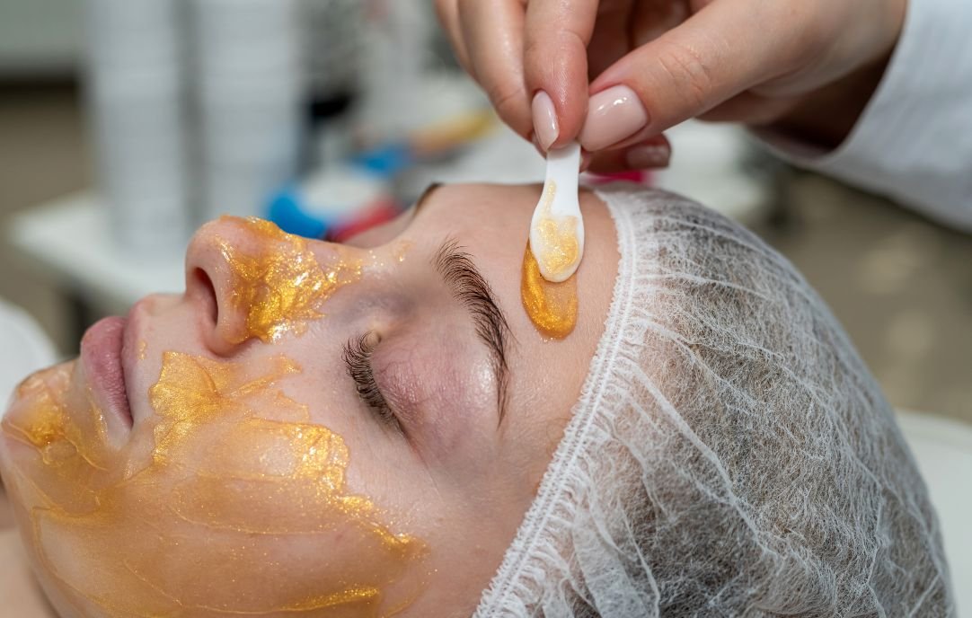 Procedimientos de Medicina Estética para Mejorar la Apariencia de las Cicatrices
