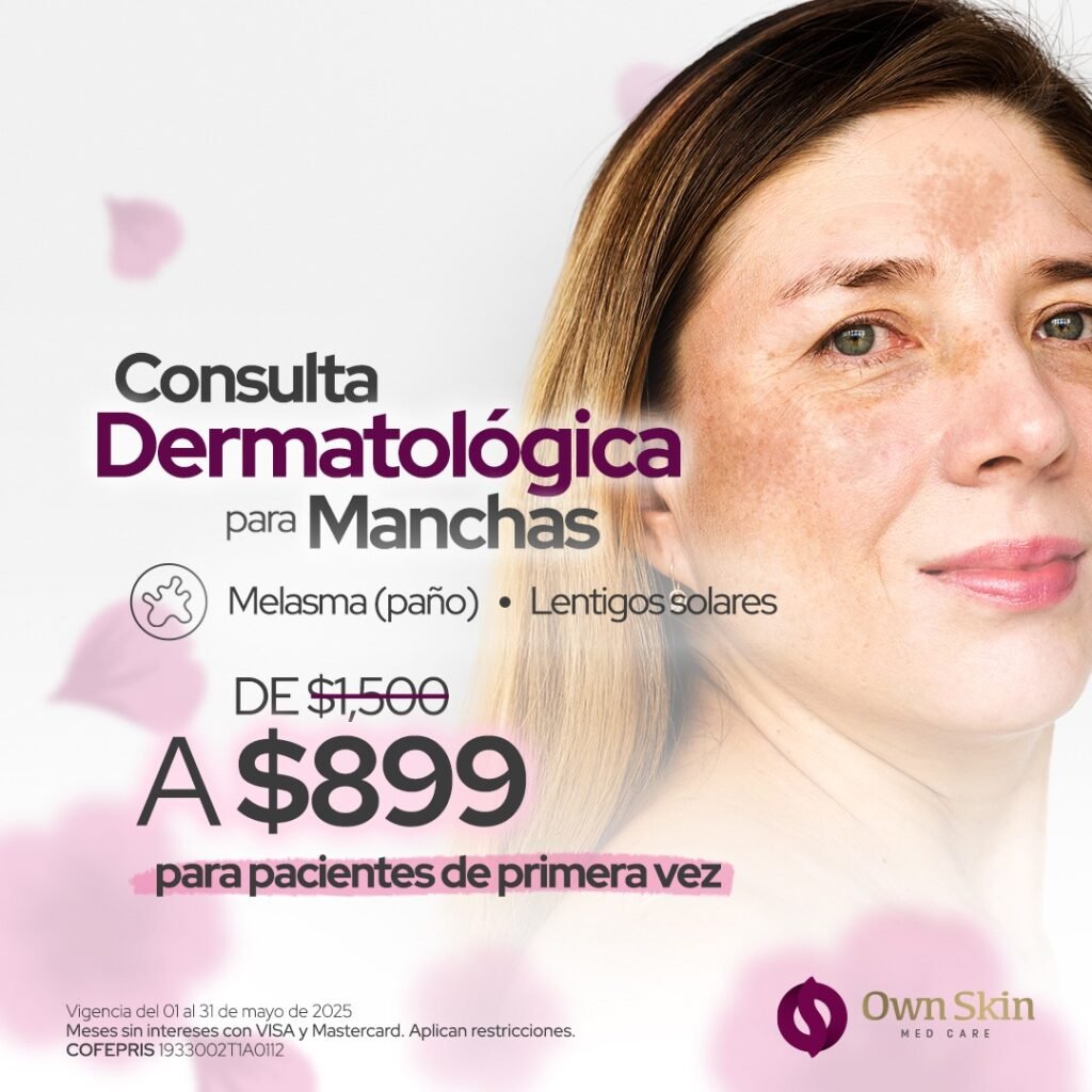 Consulta dermatológica Manchas