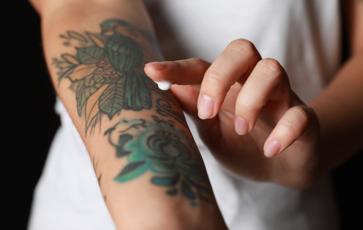 Eliminación de tatuajes