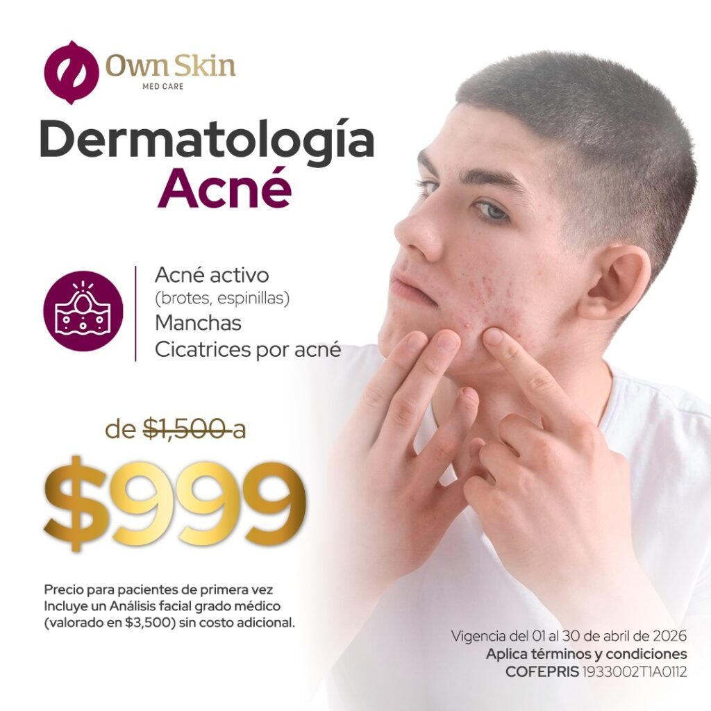 Dermatologia Acné