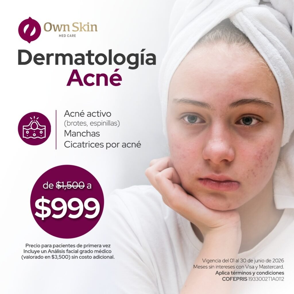 Dermatologia para acne