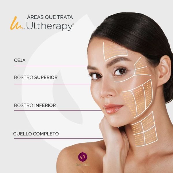 Zonas del rostro para aplicar ultherapy
